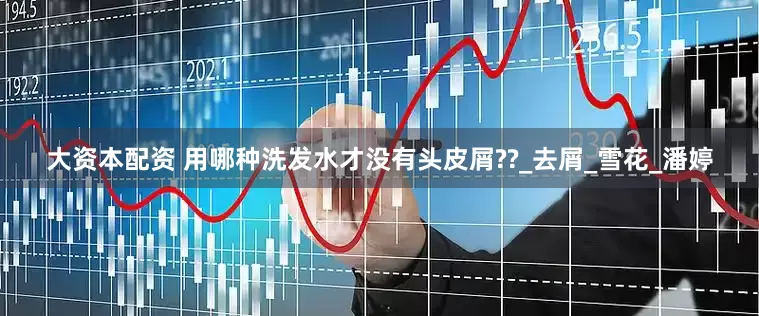 大资本配资 用哪种洗发水才没有头皮屑??_去屑_雪花_潘婷